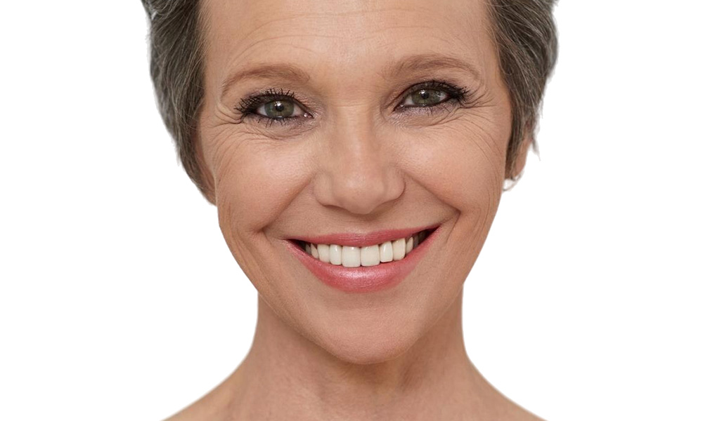 The New Natural Blepharoplasty Trend Celeb MUA