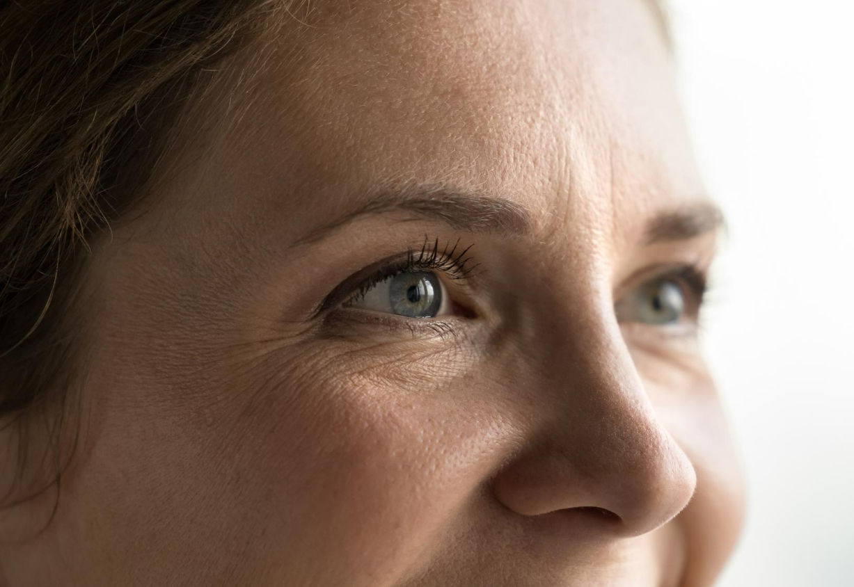 How Long After Upper Blepharoplasty Can I Wear Makeup