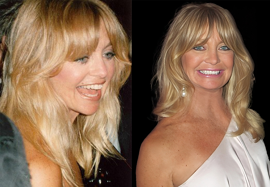 Goldie Hawn Facelift: The Actress’s Approach To Aging