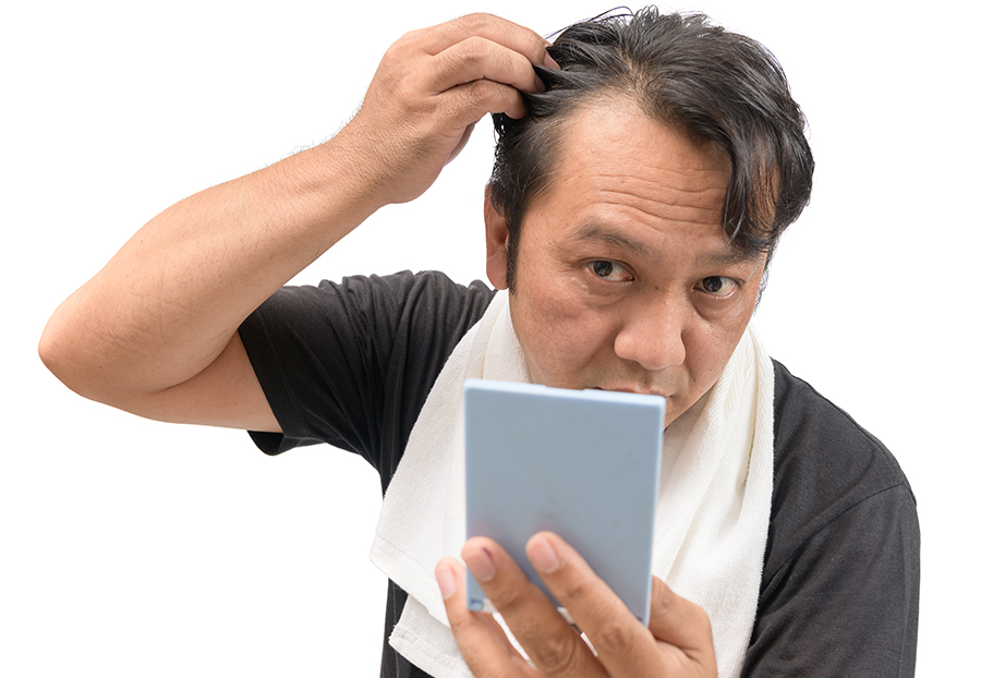 Permanent Hair Loss Solutions: Trusted Hair Transplant Experts in Raleigh, NC