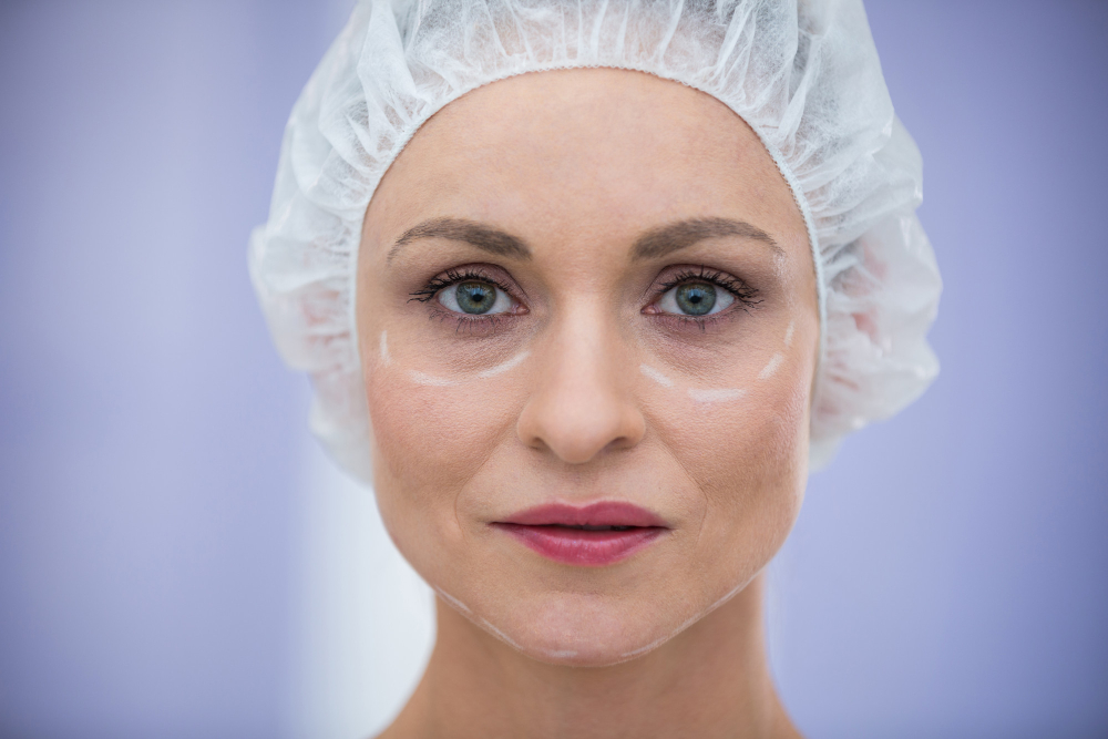 How Much Does Lower Blepharoplasty Cost in Raleigh?