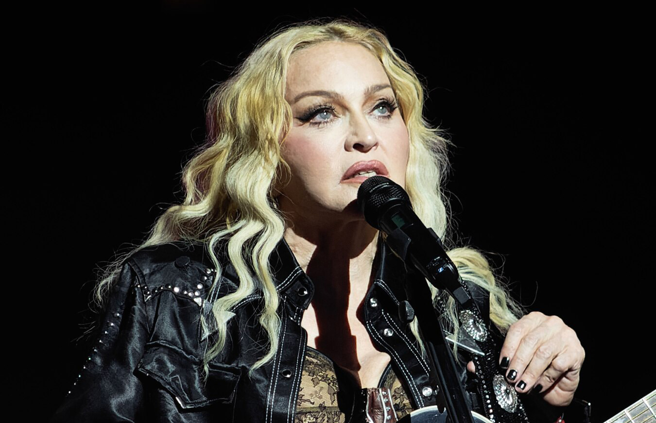 Madonna Facelift: A Look At Hollywood’s Iconic Transformations