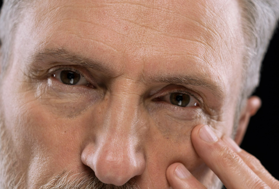 How To Massage Lower Eyelid After Blepharoplasty?