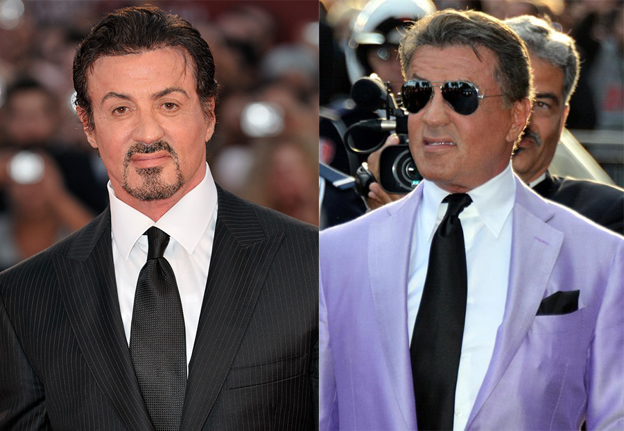 Sylvester Stallone Facelift: How Action Stars Stay Youthful