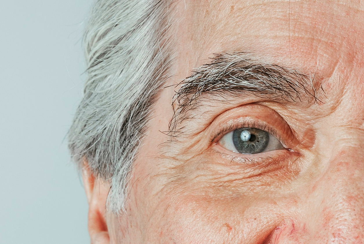 best age for blepharoplasty
