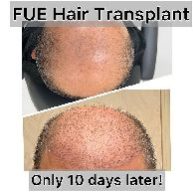 369336821_17897025416849585_1513975659563287474_n