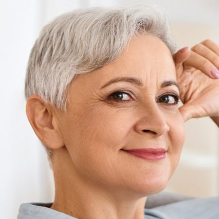 Canthopexy-Canthoplasty-04