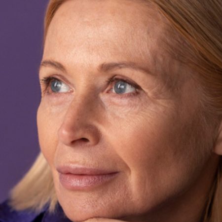 What Is Canthoplasty?