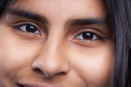 lower-blepharoplasty-04