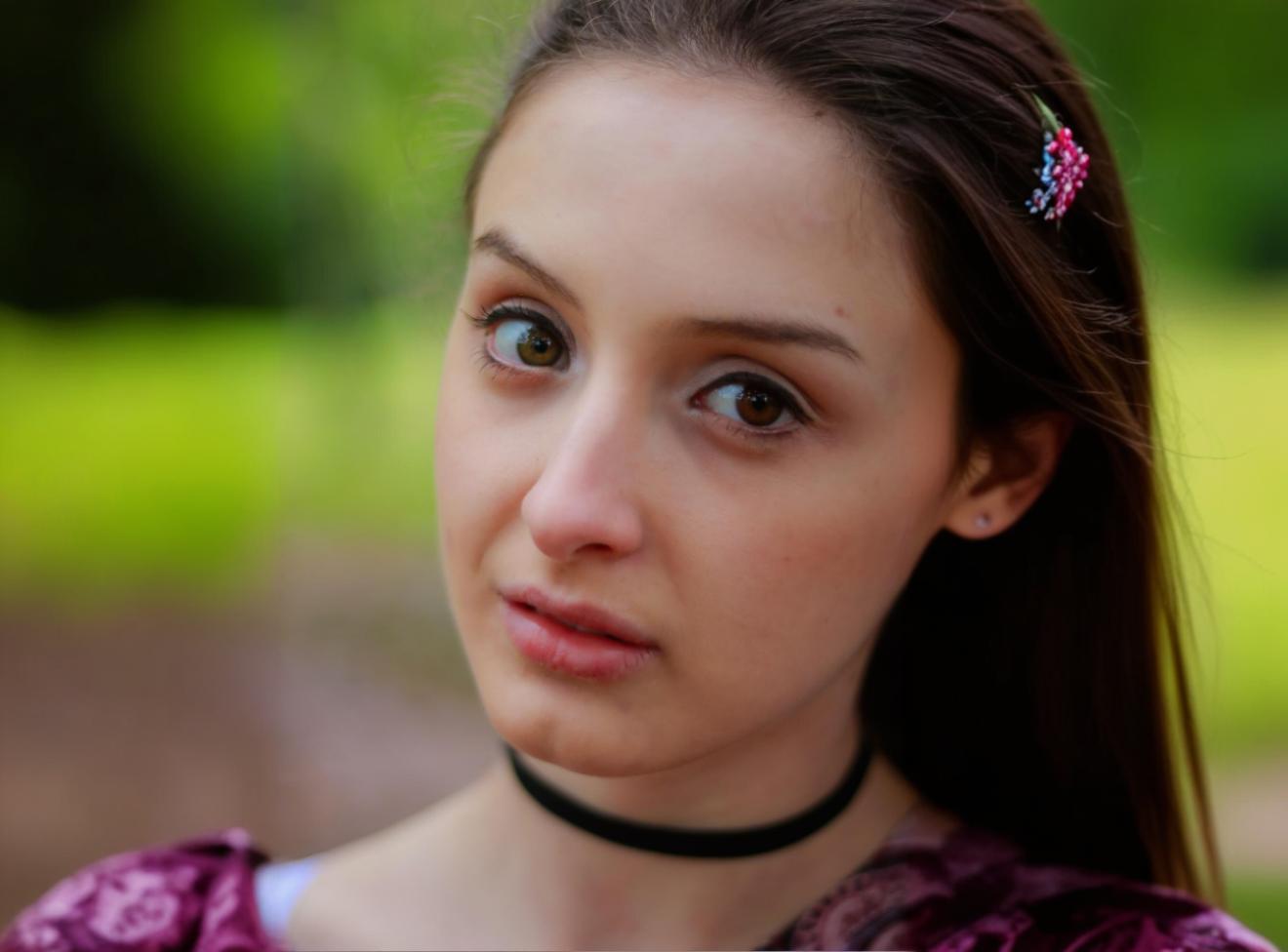 Gen Z’s Favorite ‘Doe-Eye’ Trend – Is Lower Blepharoplasty or Skincare Doing the Work?