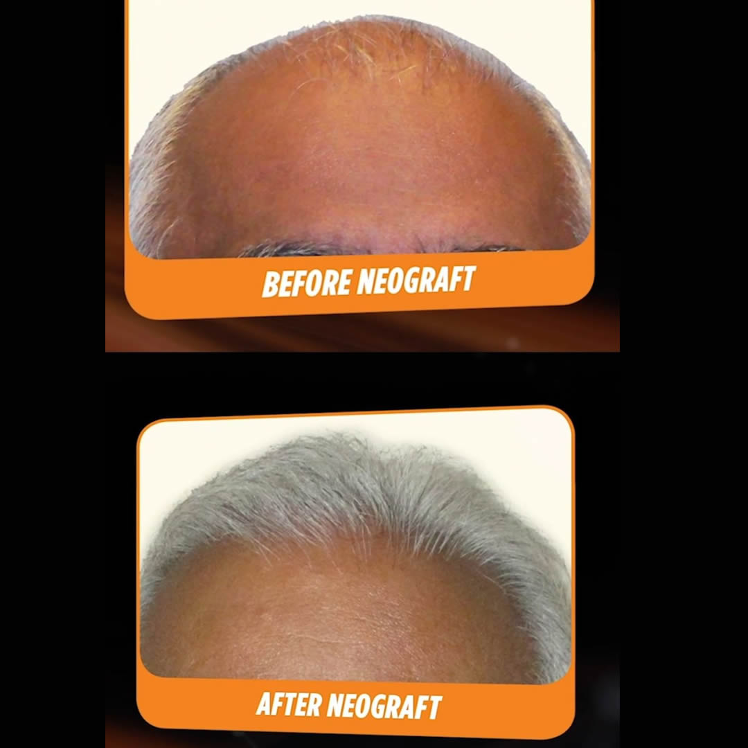 Best Plastic Surgeon Raleigh, NC Raleigh Plastic Surgery