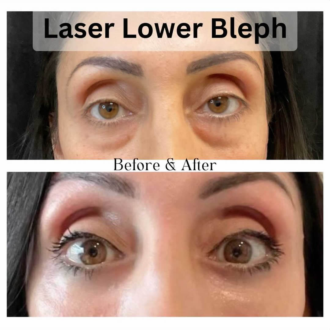 Best Plastic Surgeon Raleigh, NC Raleigh Plastic Surgery