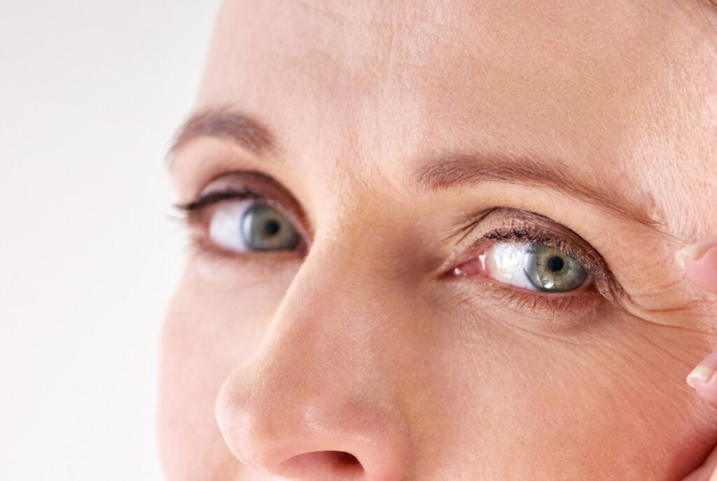 Lower Blepharoplasty for Under-Eye