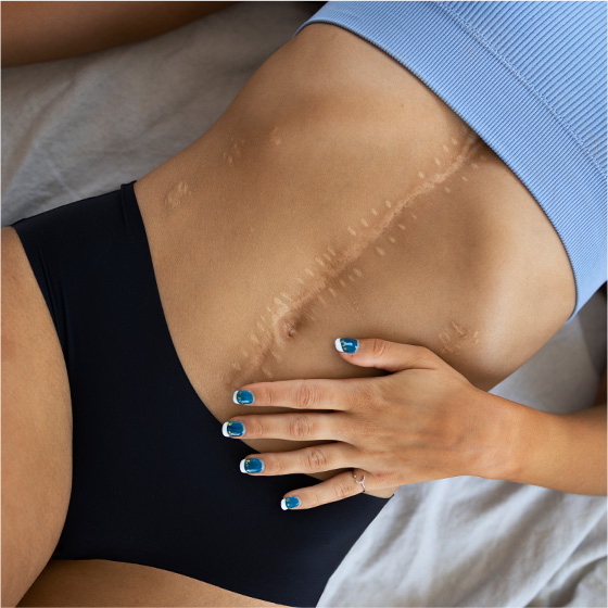 Ultraclear Surgical Scar Treatment Raleigh Nc Dr Jindal