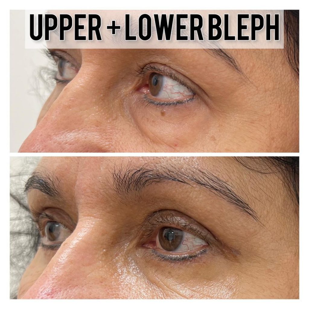 Best Plastic Surgeon Raleigh, NC Raleigh Plastic Surgery